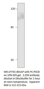 ADCY8 Antibody in Western Blot (WB)