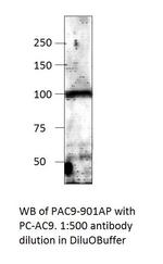 ADCY9 Polyclonal Antibody