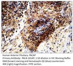 PACAP Polyclonal Antibody