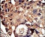 PACSIN1 Antibody in Immunohistochemistry (IHC)