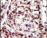 PACSIN1 Antibody in Immunohistochemistry (IHC)
