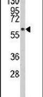PACSIN1 Antibody in Western Blot (WB)