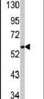 PACSIN1 Antibody in Western Blot (WB)
