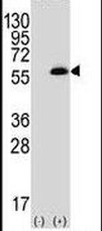 PACSIN1 Antibody in Western Blot (WB)