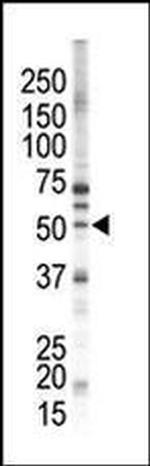 PACSIN1 Antibody in Western Blot (WB)