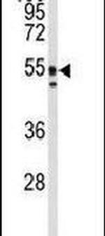PACSIN1 Antibody in Western Blot (WB)