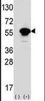 PACSIN1 Antibody in Western Blot (WB)
