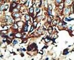 PACSIN2 Antibody in Immunohistochemistry (IHC)