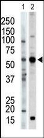 PACSIN2 Antibody in Western Blot (WB)