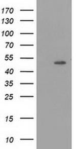 PACSIN3 Antibody in Western Blot (WB)