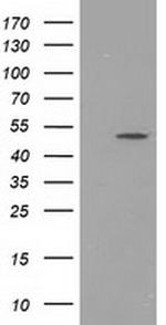 PACSIN3 Antibody in Western Blot (WB)