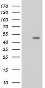 PACSIN3 Antibody in Western Blot (WB)