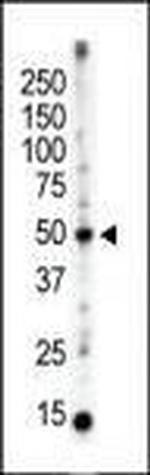 PACSIN3 Antibody in Western Blot (WB)