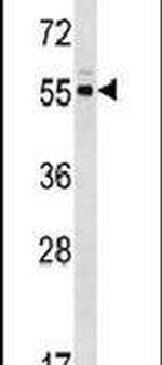 PACSIN3 Antibody in Western Blot (WB)