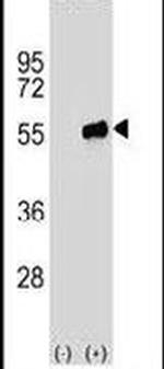 PACSIN3 Antibody in Western Blot (WB)