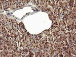 PADI4 Antibody in Immunohistochemistry (Paraffin) (IHC (P))