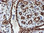 PADI4 Antibody in Immunohistochemistry (Paraffin) (IHC (P))