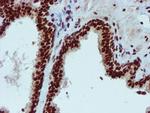 PADI4 Antibody in Immunohistochemistry (Paraffin) (IHC (P))