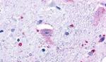 GPR37 Antibody in Immunohistochemistry (Paraffin) (IHC (P))
