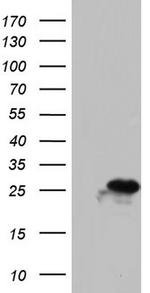 PAFAH1B3 Antibody in Western Blot (WB)