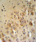 SERPINB2 Antibody in Immunohistochemistry (IHC)