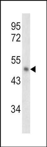 SERPINB2 Antibody in Western Blot (WB)
