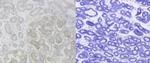 PAI1 Antibody in Immunohistochemistry (IHC)