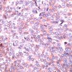 PAK2 Antibody in Immunohistochemistry (IHC)