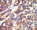 PAK2 Antibody in Immunohistochemistry (IHC)