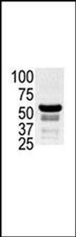 PAK2 Antibody in Western Blot (WB)