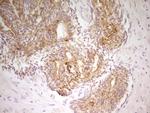 PAK4 Antibody in Immunohistochemistry (Paraffin) (IHC (P))