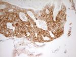 PAK4 Antibody in Immunohistochemistry (Paraffin) (IHC (P))