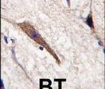 PAK7 Antibody in Immunohistochemistry (IHC)
