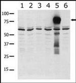 PAK7 Antibody in Western Blot (WB)