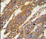 PAN3 Antibody in Immunohistochemistry (IHC)