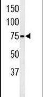 PAN3 Antibody in Western Blot (WB)