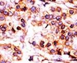 PANK1 Antibody in Immunohistochemistry (IHC)