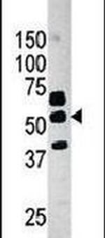 PANK2 Antibody in Western Blot (WB)