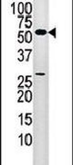 PANK2 Antibody in Western Blot (WB)