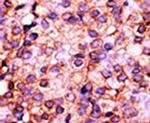 PANK3 Antibody in Immunohistochemistry (IHC)