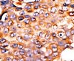 PANK3 Antibody in Immunohistochemistry (IHC)