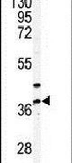 PANK3 Antibody in Western Blot (WB)