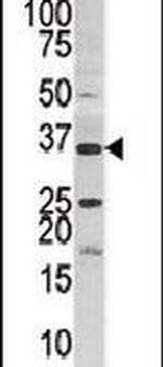 PANK3 Antibody in Western Blot (WB)