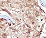 PAPSS2 Antibody in Immunohistochemistry (IHC)