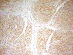PAPSS2 Antibody in Immunohistochemistry (Paraffin) (IHC (P))