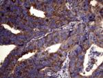 PAPSS2 Antibody in Immunohistochemistry (Paraffin) (IHC (P))