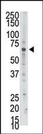 PAPSS2 Antibody in Western Blot (WB)