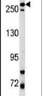 LRRK2 Antibody in Western Blot (WB)