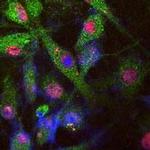 LRRK2 Antibody in Immunocytochemistry (ICC/IF)