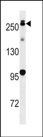 LRRK2 Antibody in Western Blot (WB)